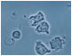 Descripción: ::tiffs:TIFFS PER A EXAMEN:pantallazos:baix dpi:globuls-blancs-microscopi.jpg