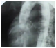 Descripción: ::tiffs:TIFFS videos:pantallazos:baix dpi:5-07-aorta-RX.jpg